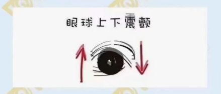什么是眼球震顫？
