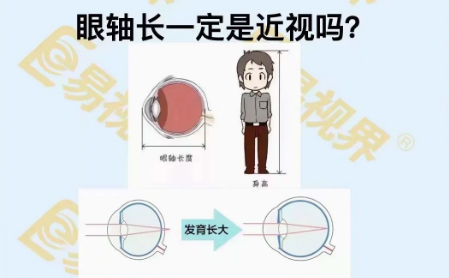 眼軸長一定是近視嗎？