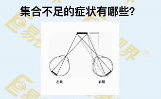 集合不足的癥狀有哪些？